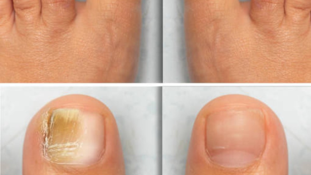 Nail & Foot Care