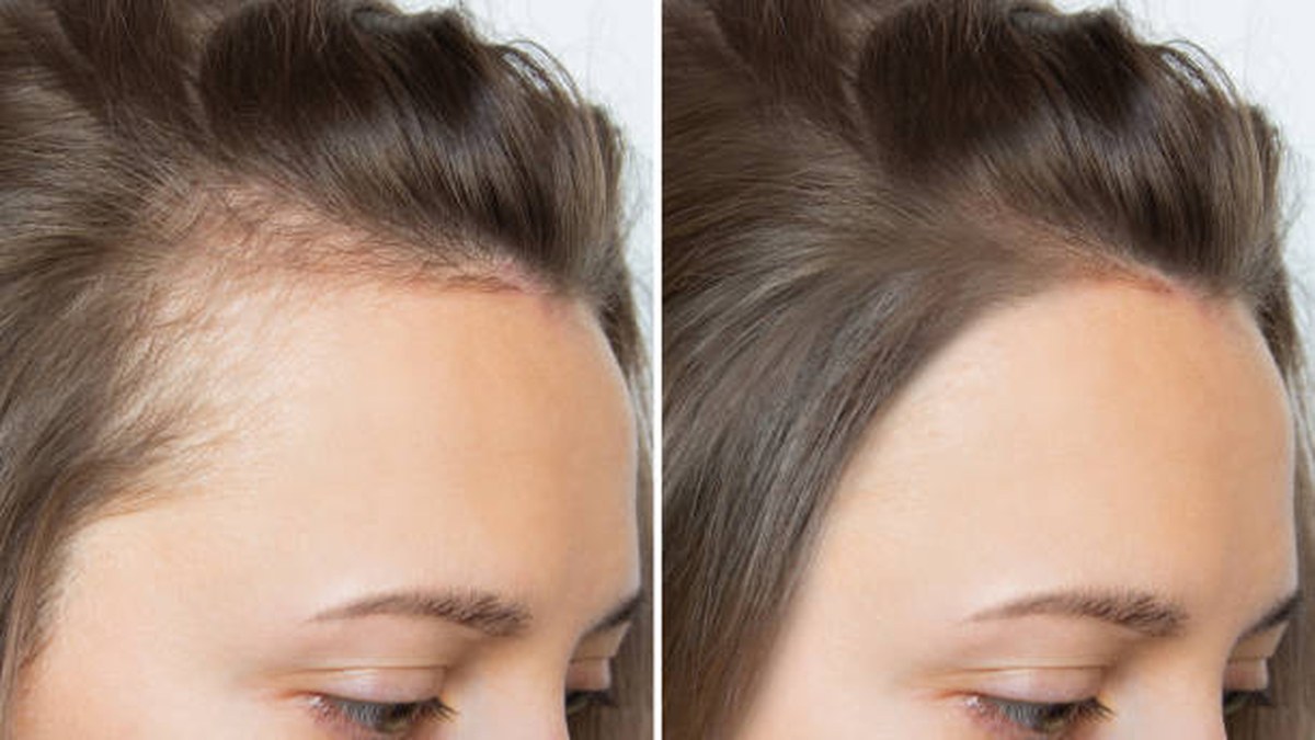 Hair Wellness